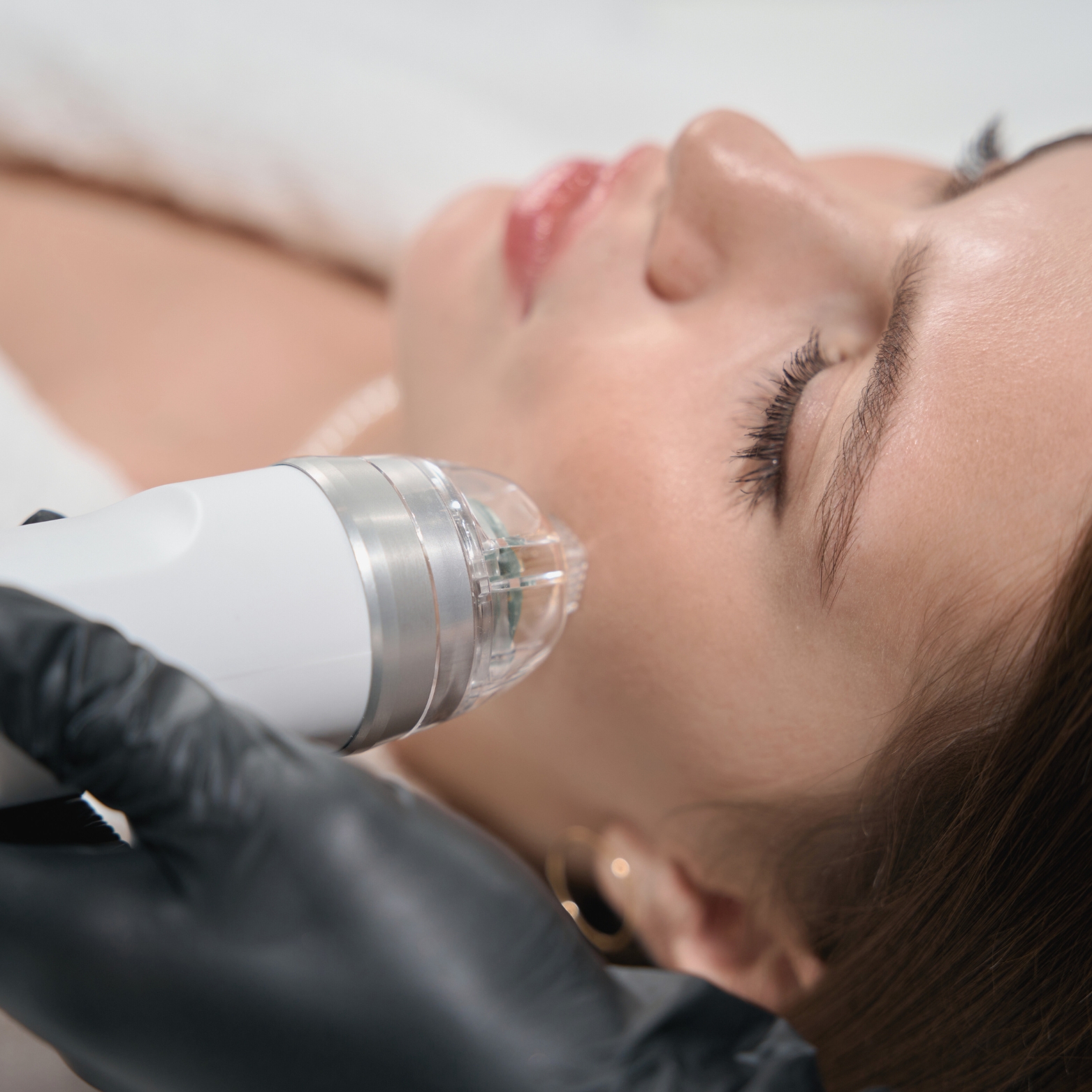 Korean Microneedling