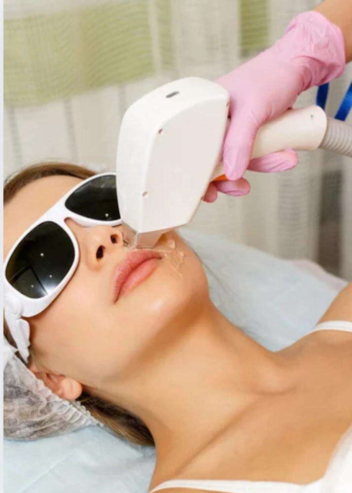 Half Face IPL Hair Removal at Island Glow in Londonderry, NH