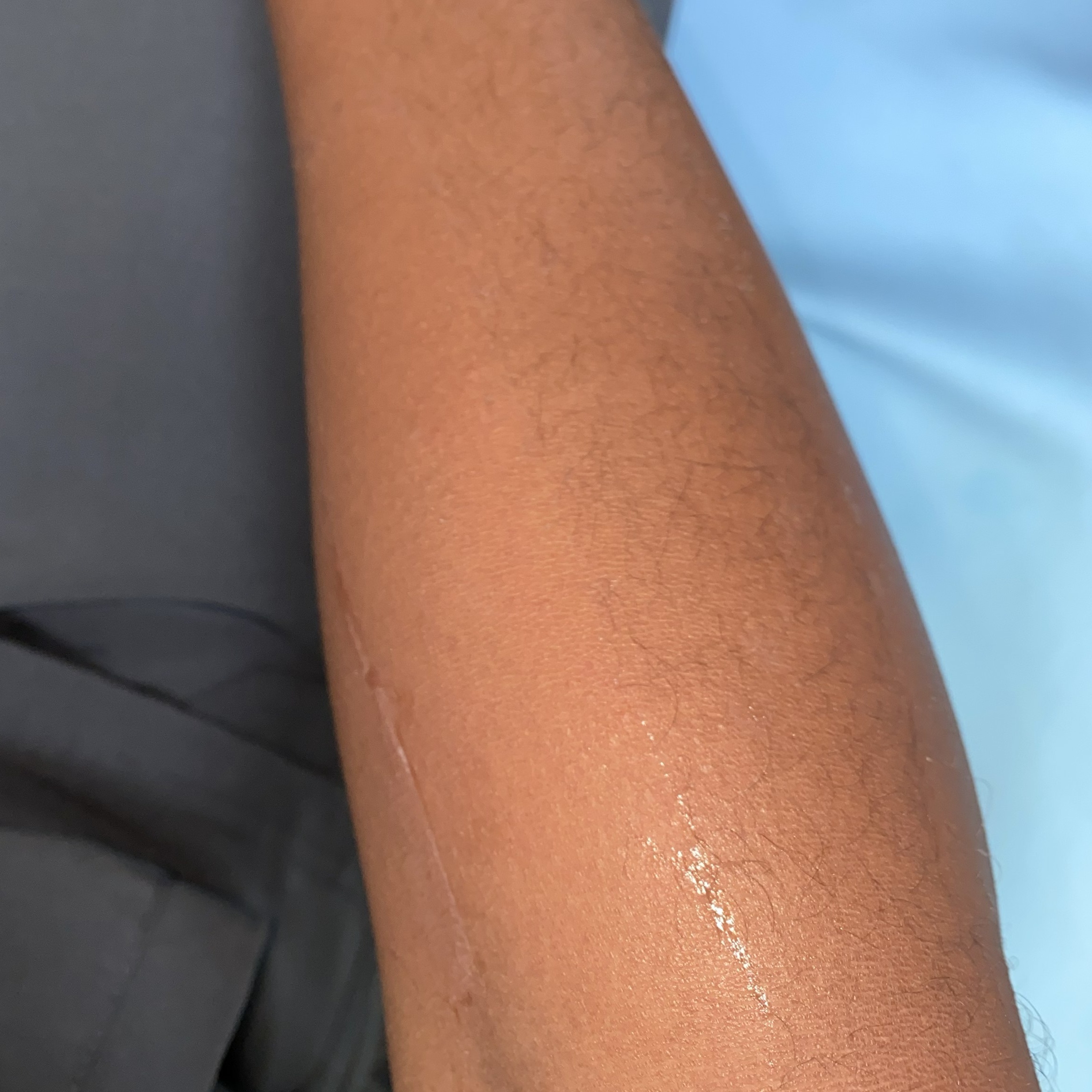 1/2 Arm Hair Removal at Crown Of Essence Hair Studio in COLUMBUS, GA