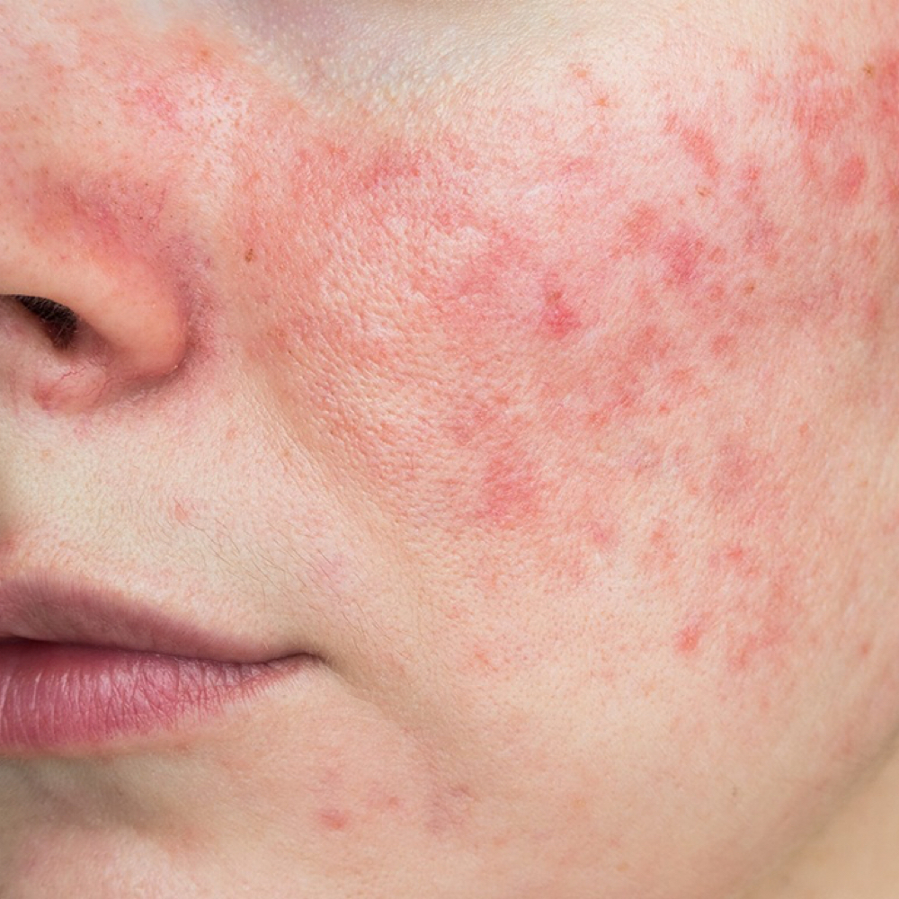 Thyme To Soothe - Sensitive at Tiff Thyme Esthetics