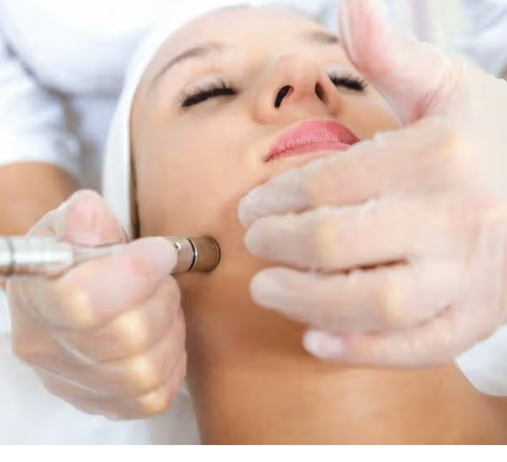 Microdermabrasion Facial