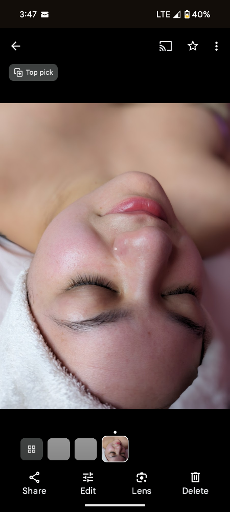 Customized Facial