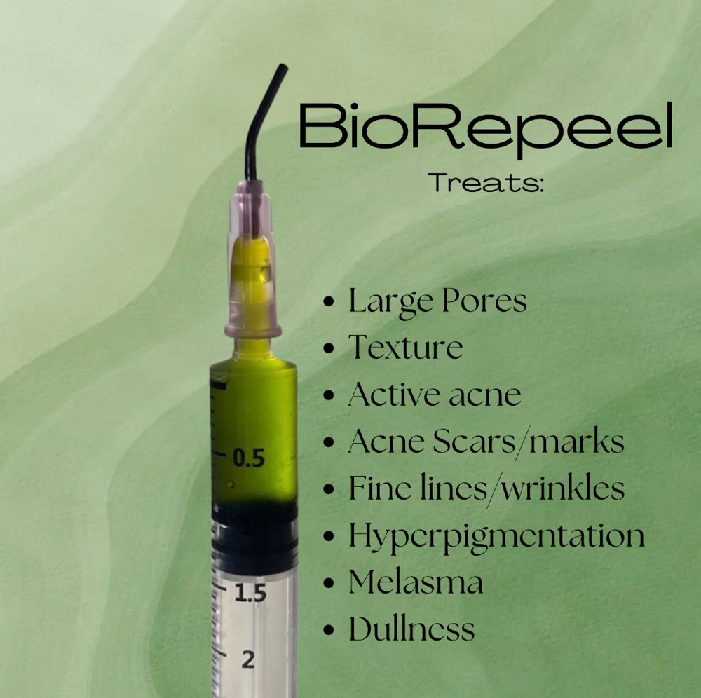 Fall Bio RePeel Facial Special