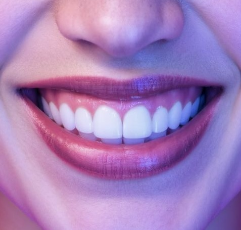 60 Minute Whitening