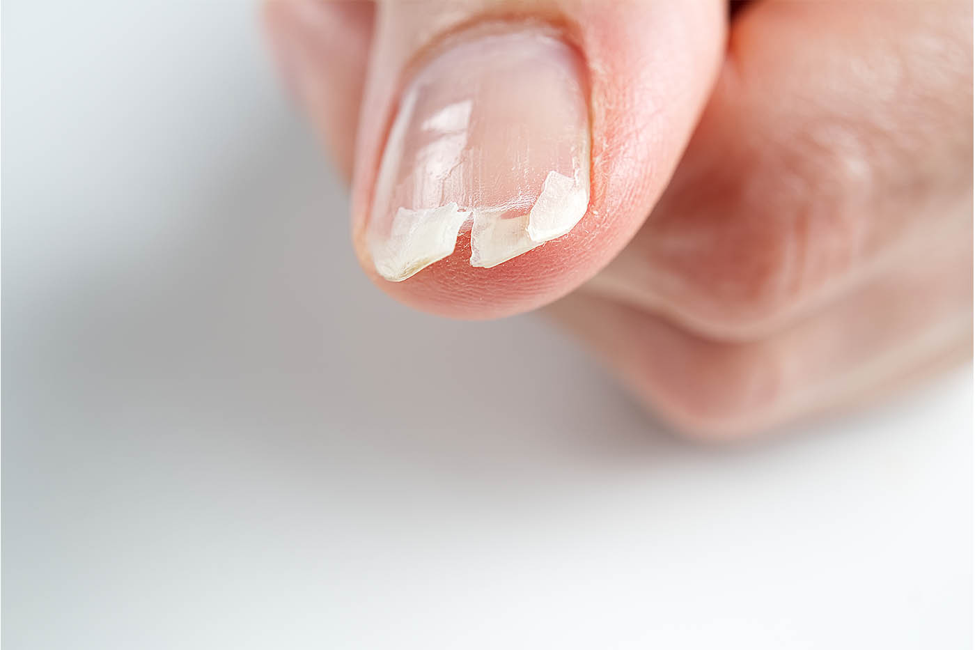 Nail Repair