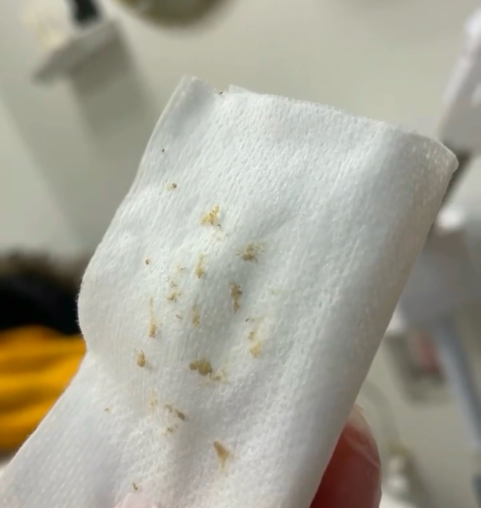 Deep Extractions