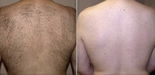 Waxing - Full Back