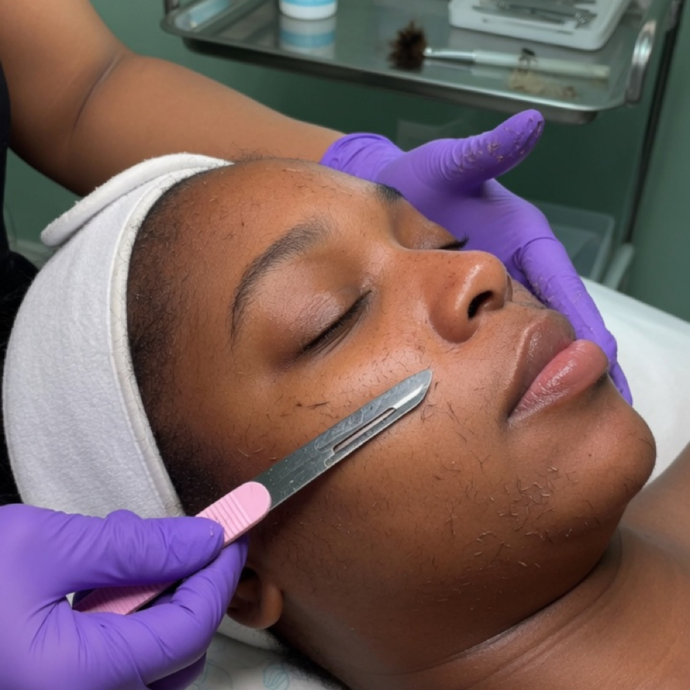 Dermaplaning Treatment at Zen Essence Spa & Wellness in Brooklyn, NY