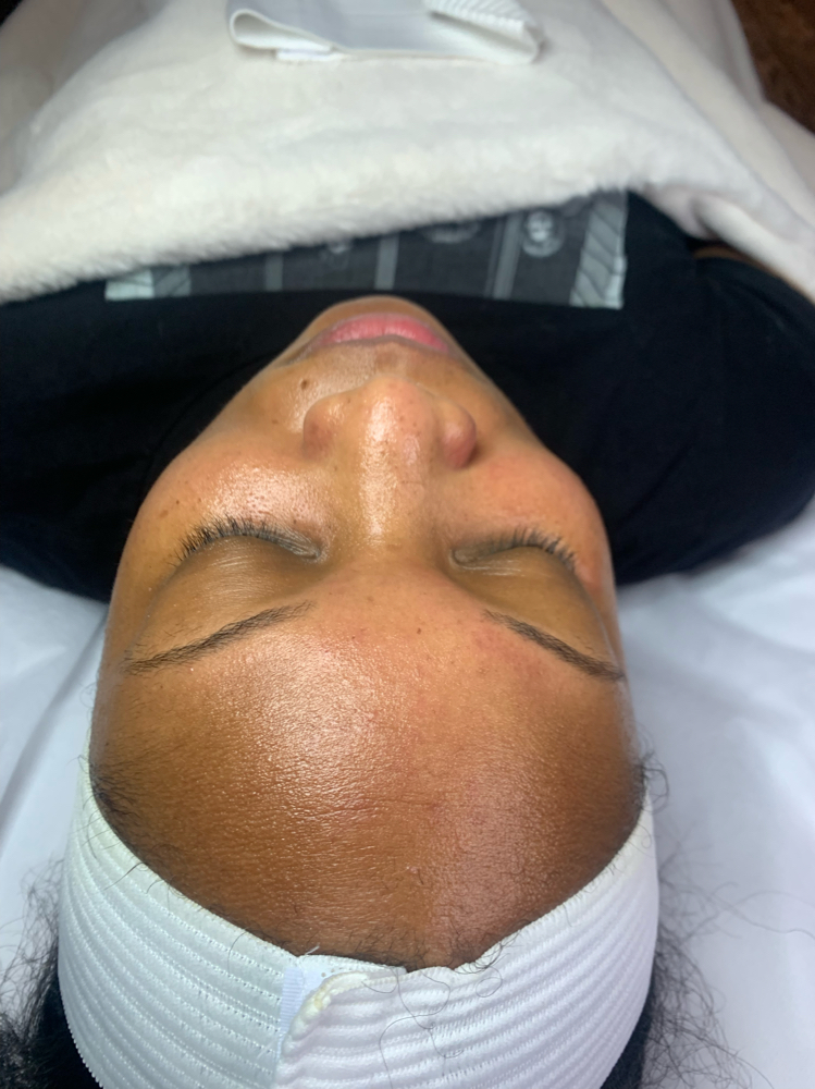 Welcome Facial - Consult & Treat