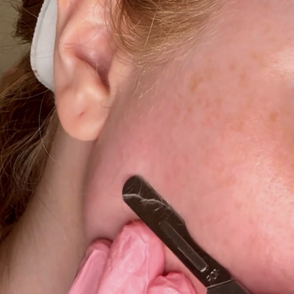 Dermaplane Facial at Timberly B Esthetics LLC in Hoschton, GA