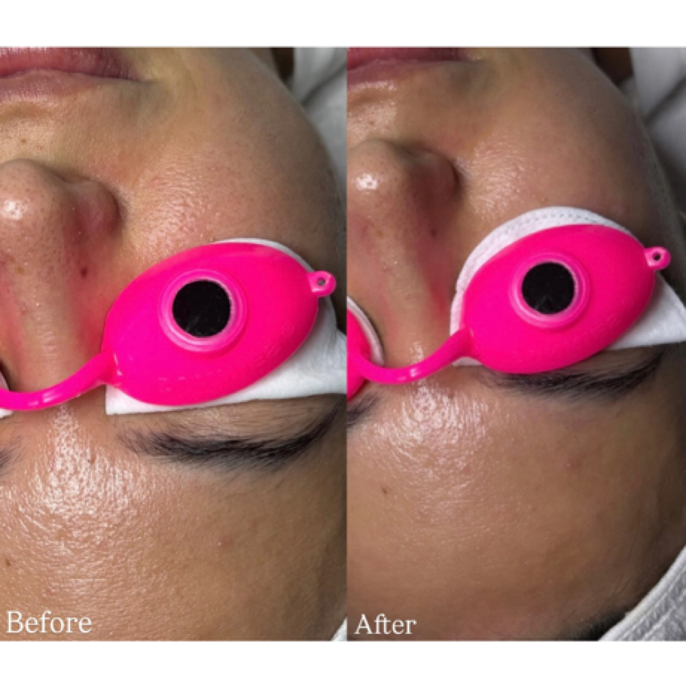 The Youth Filter at Glammed By Lalli in San Jose, CA