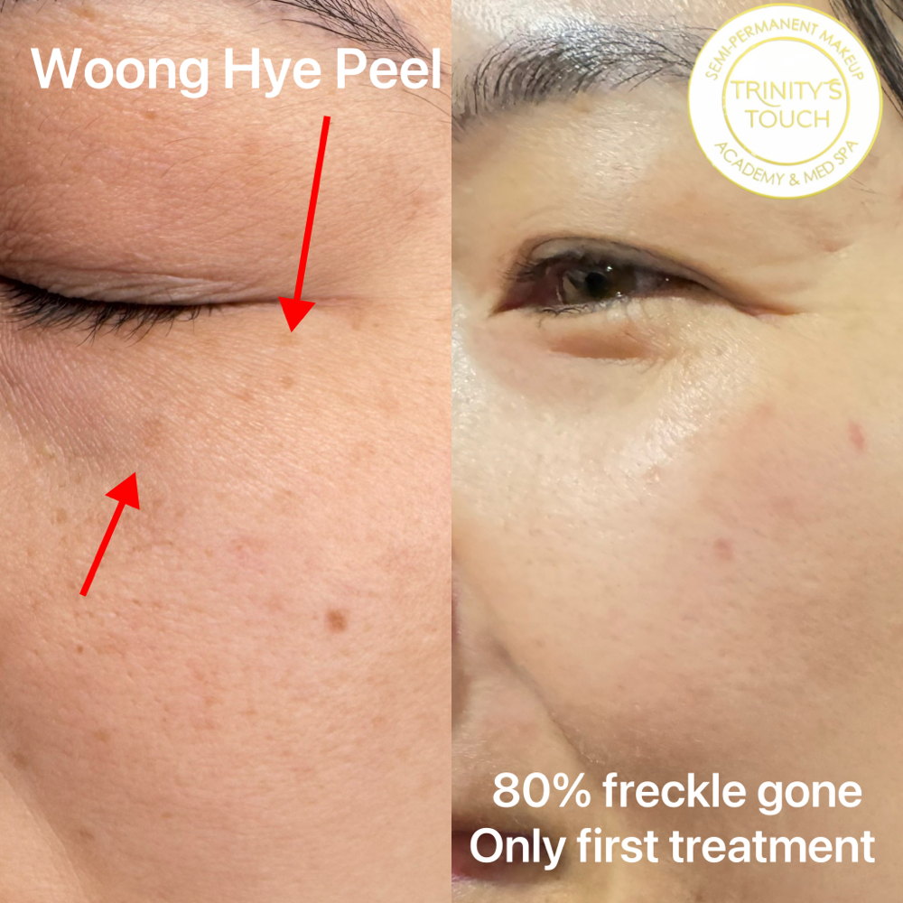 WOONG HYE PEEL