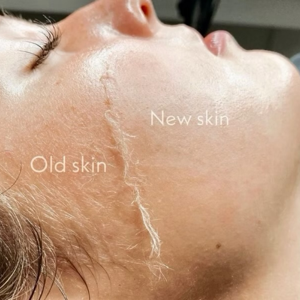 Dermaplaining Facial at Euphoria Skin & Hair in Litchfield Park, AZ