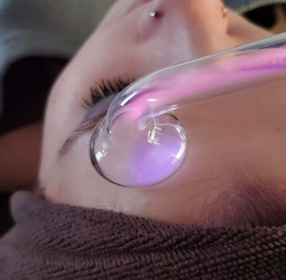 High Frequency ADD ON TO FACIAL