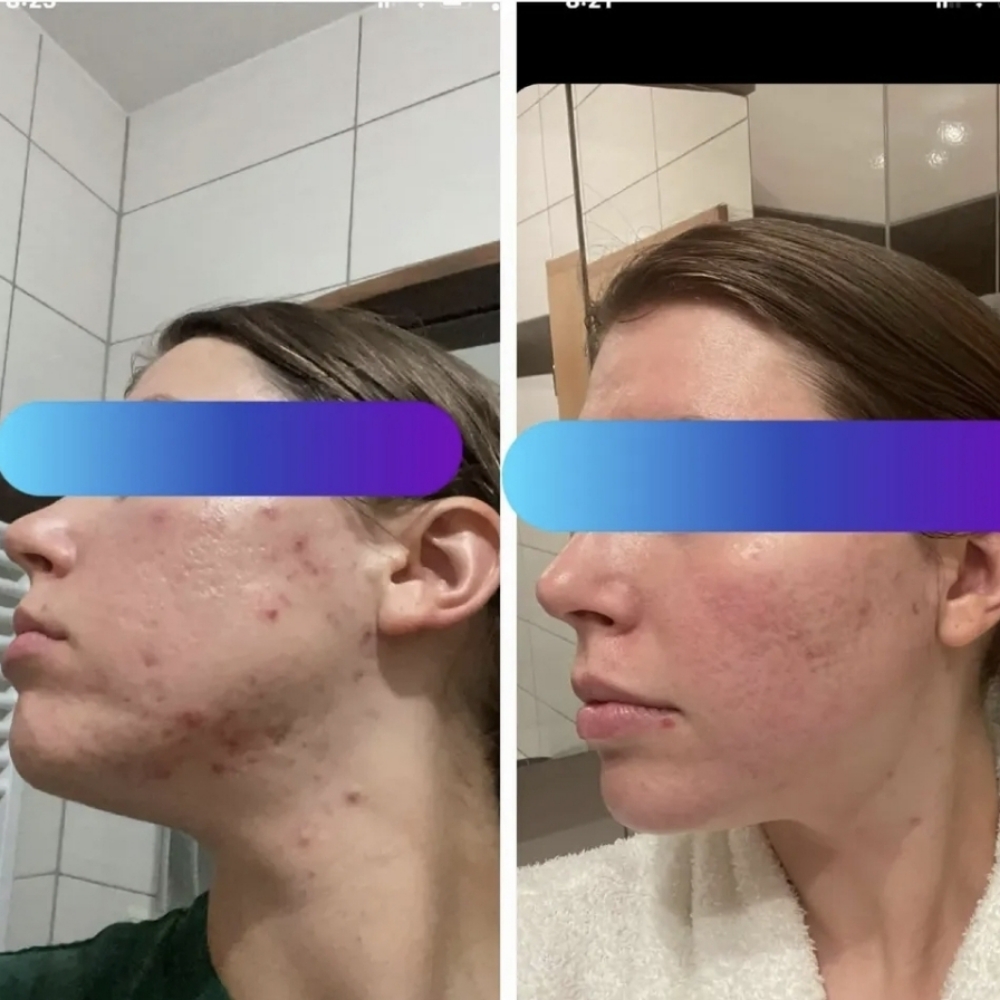 Custom Facial at Skyn by Gwyn Spa Services in Port Royal, SC