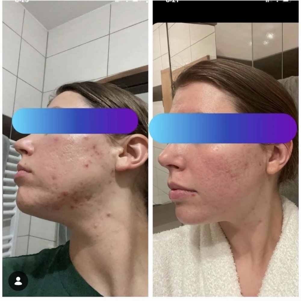 Custom Facial at Skyn by Gwyn Spa Services in Port Royal, SC