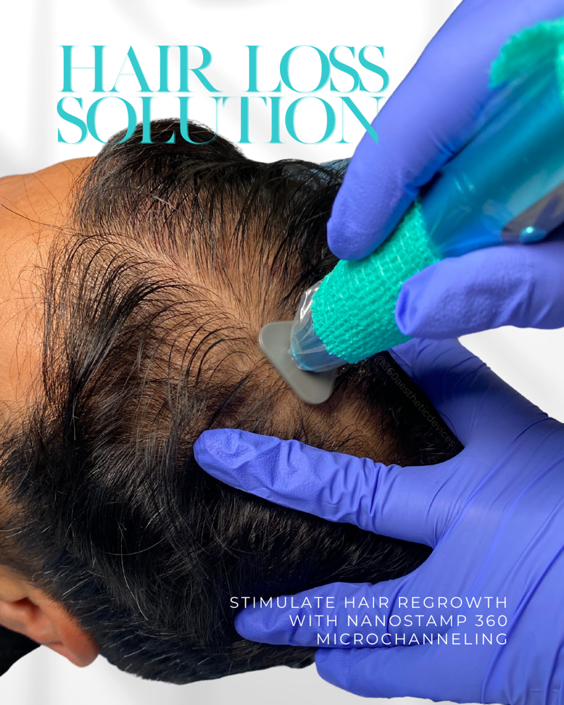Micro-Channeling Scalp