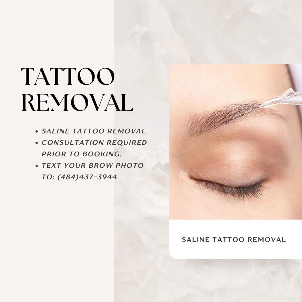 Tattoo Removal /Ligtening