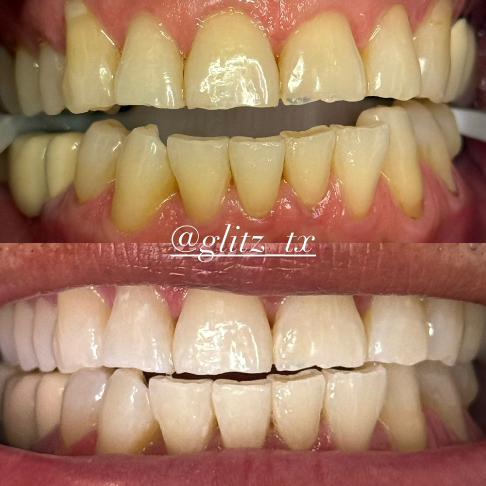 GLAM WHITE at Glitz_Tx in San Antonio, TX