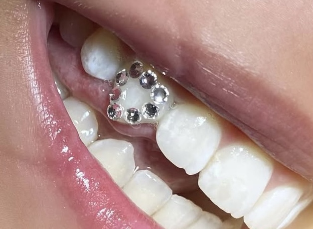 Tooth Gems (round)