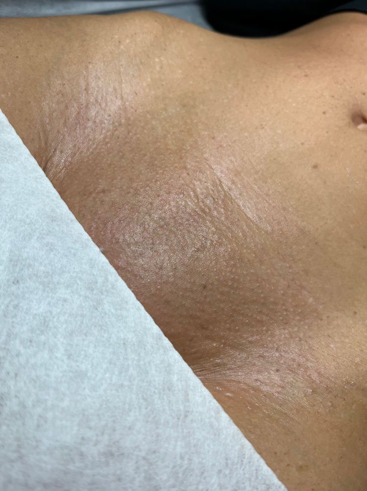 Brazilian Wax