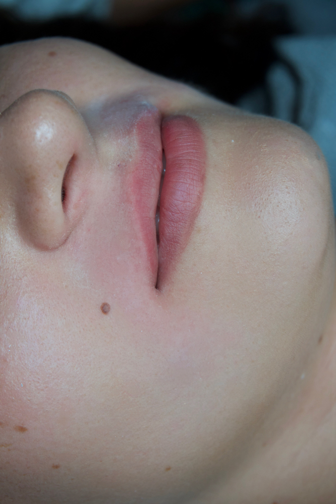 1 Facial Area (for women)