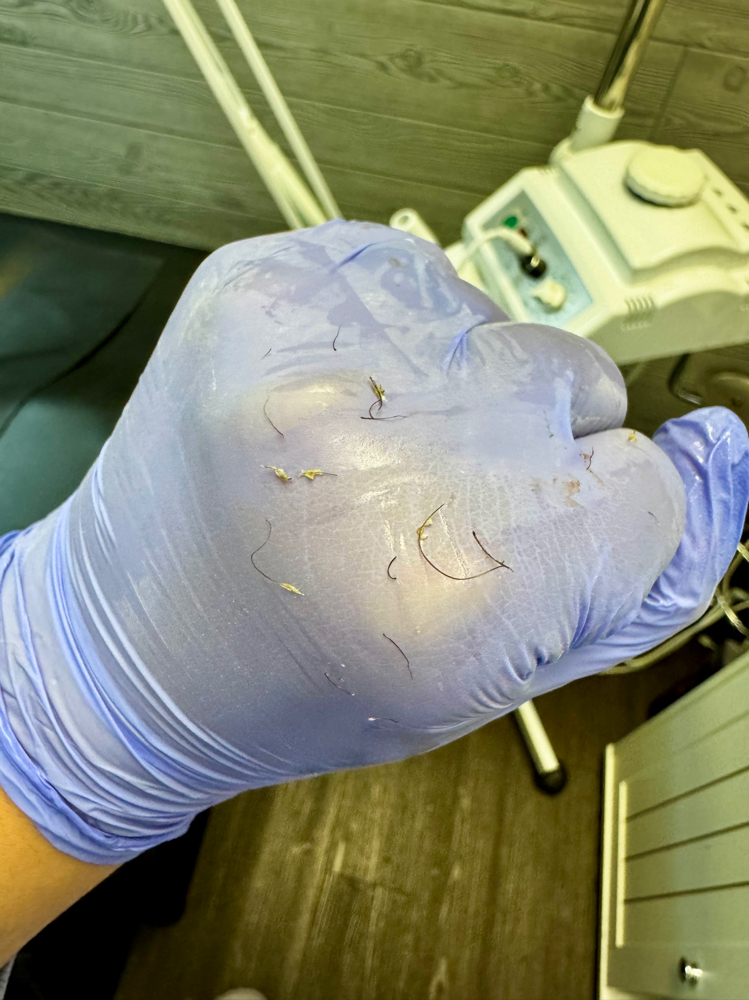 Extractions