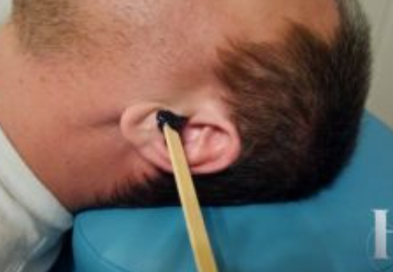 Ear Wax
