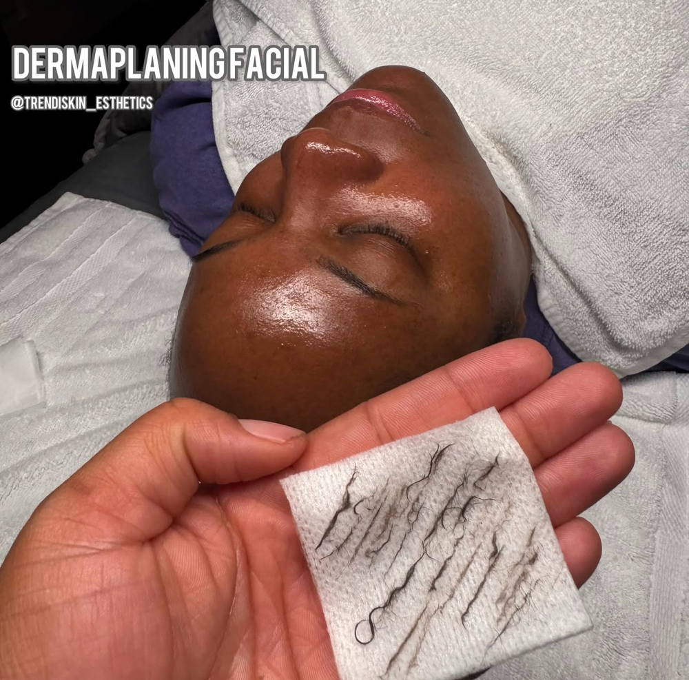 Dermaplaning Facial