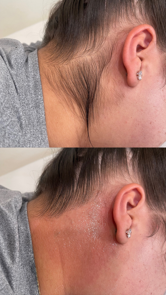 Neck Wax