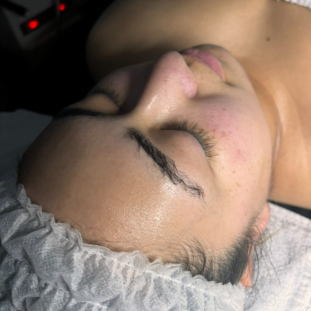 Express Facial at Pearly Derm in Sun valley, CA
