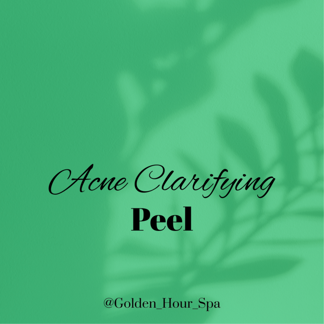 Acne Clarifying Peel at Golden Hour Spa in Toms River, NJ