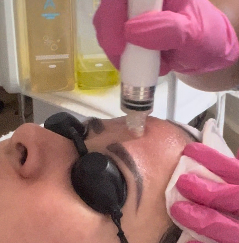 Signature Hydrafacial