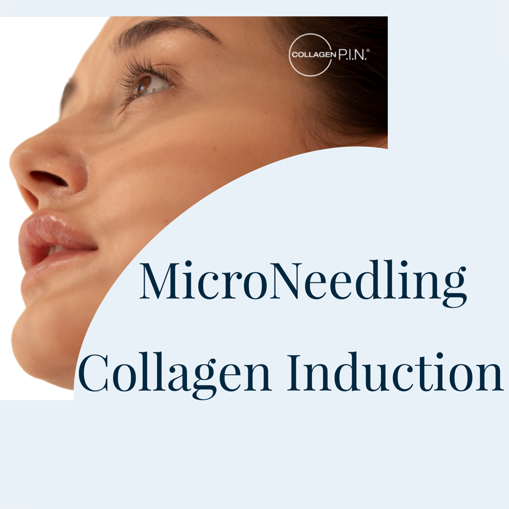 Collagen Induction “vampire Facial”