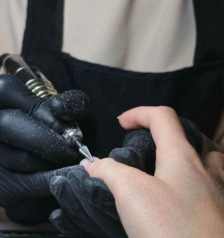 Enhancement Removal at Luxe After Dark in London, OH