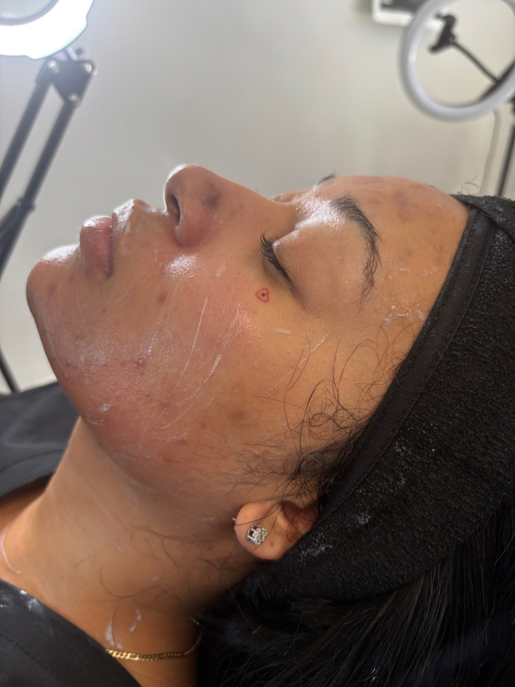 Clear Confidence Facial