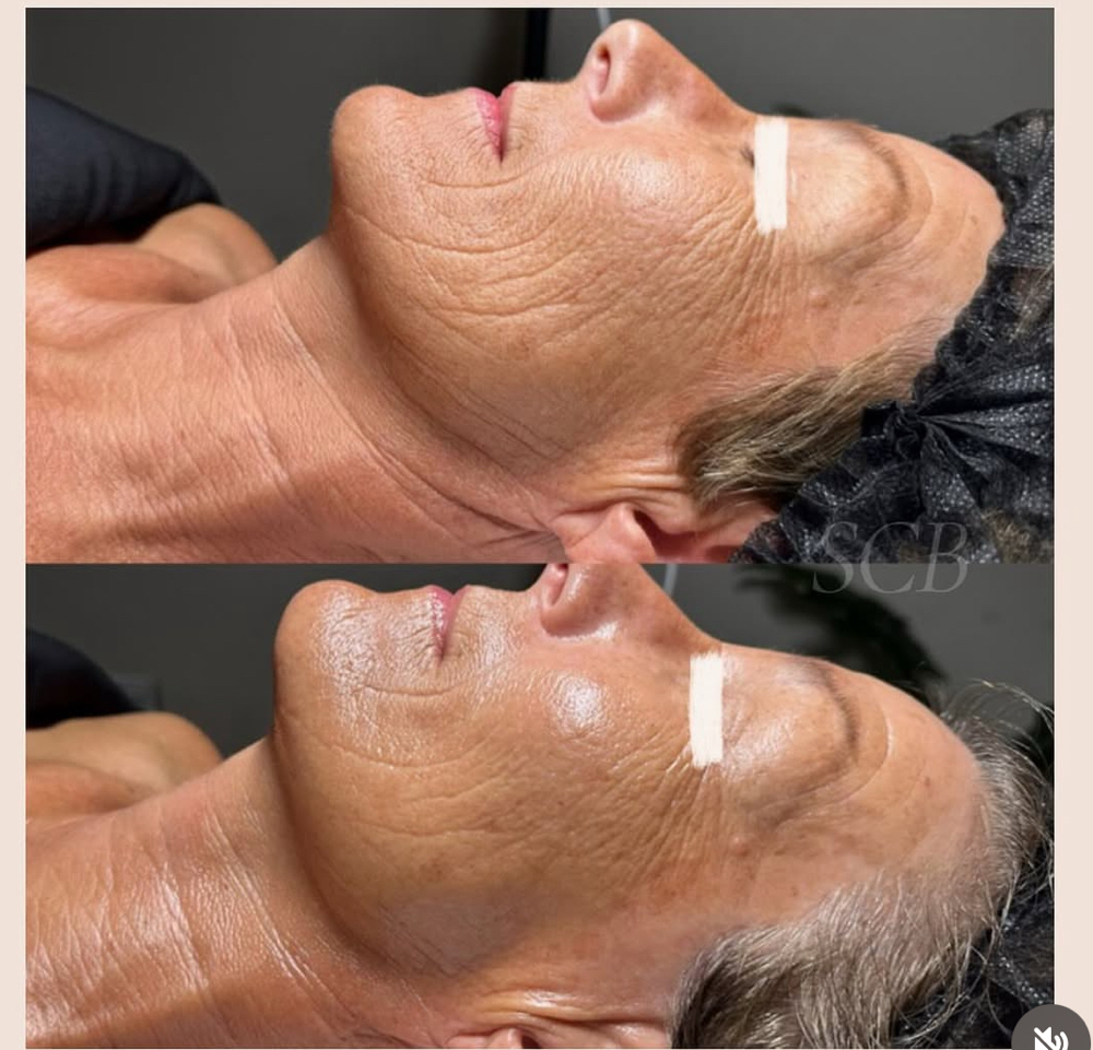 SCB GOLDEN FACIAL