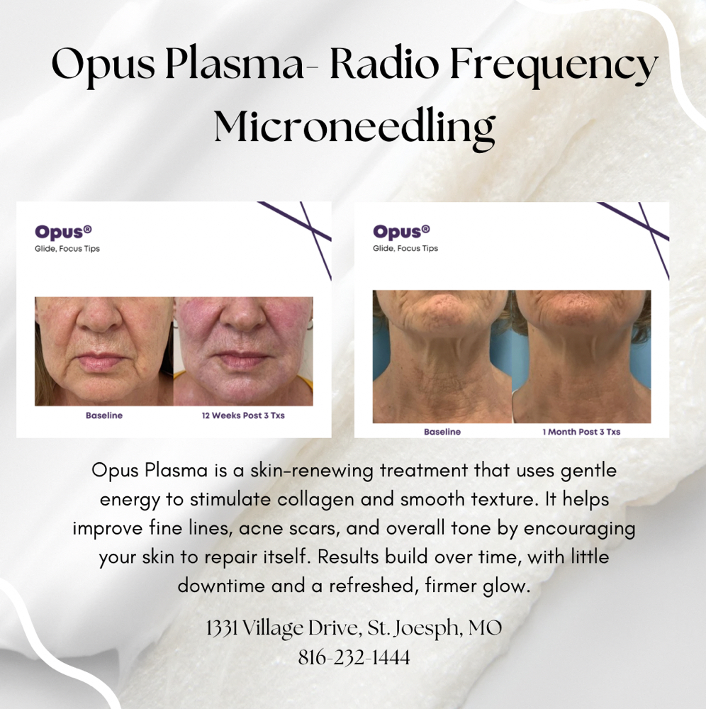 Opus Plasma Resurfacing Consult at Illuminate Dentistry & Aesthetics in St. Joseph, MO