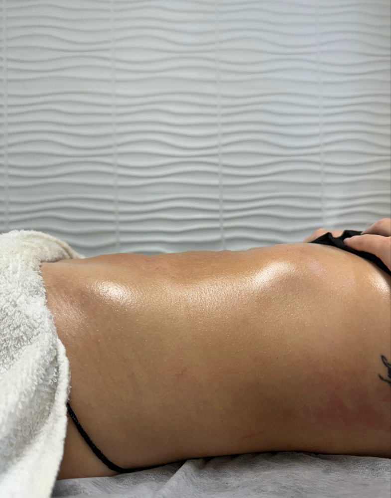 PostOp Lymphatic Drainage