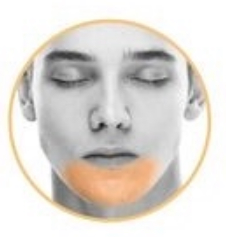 EXTENDED CHIN Laser Hair Removal