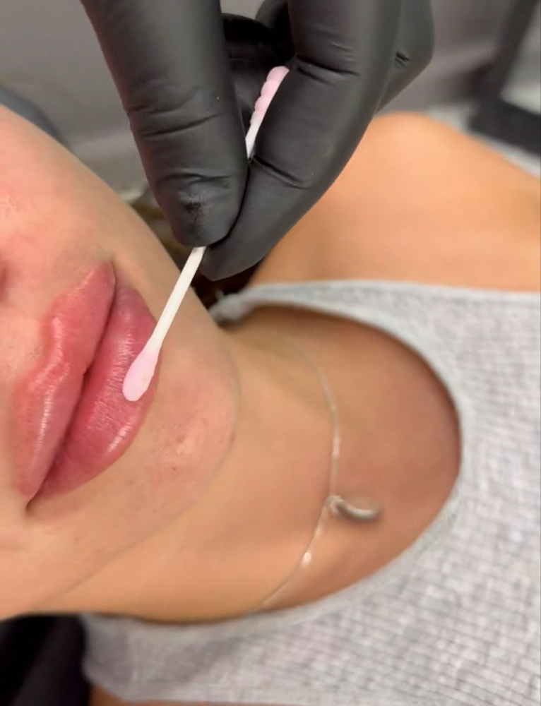 Lip Treatment