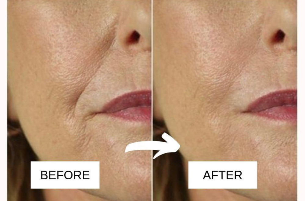 Anti-aging Facial