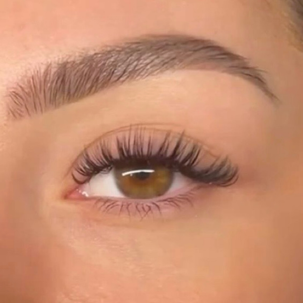 Classic Fill at Stillwater esthetics in Elmer City, WA