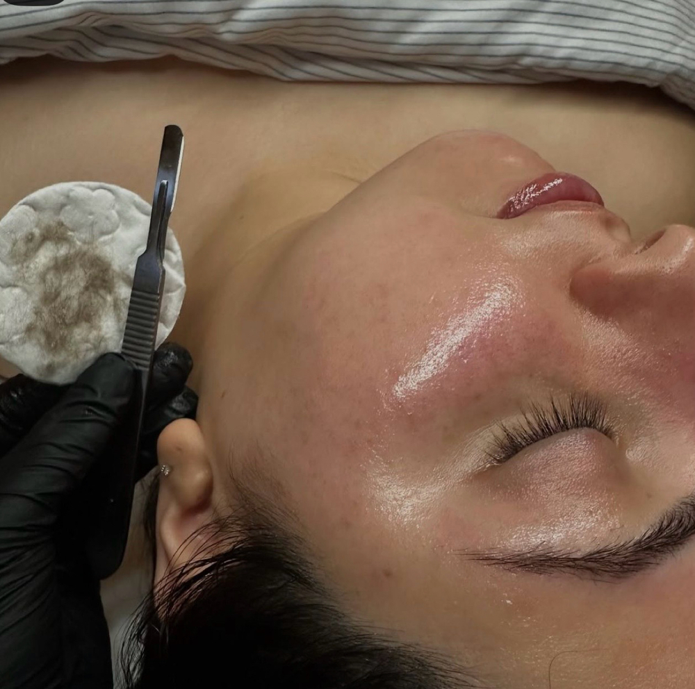 Dermaplane add on to any facial at Olive.glowesthetics in West Monroe, LA