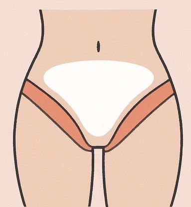 The Signature BareSkin Vajacial at BareSkinAesthetics in Ridgeland, MS