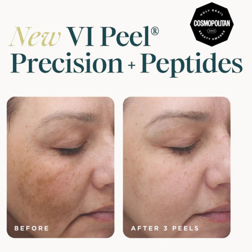 VI Peel® Chemical Peel Package of 3 at SKIN CLINIC GUINOT PARIS in Laguna Hills, CA