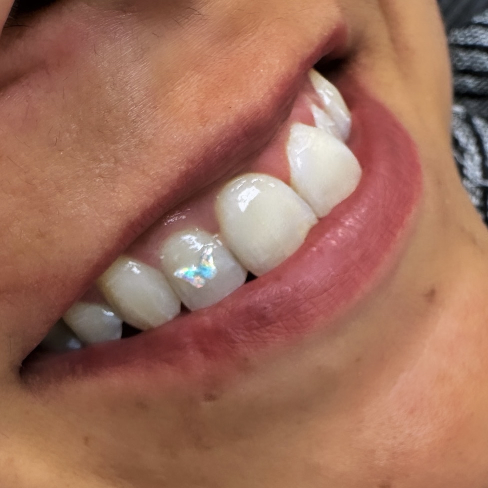 Opal Tooth Charm