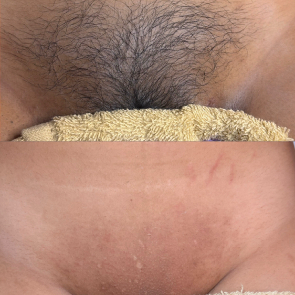 Brazilian Wax at Blush Hair & Beauty in harlingen, TX