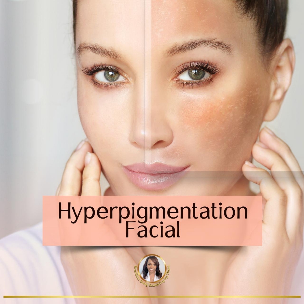 Hyperpigmentation Facial