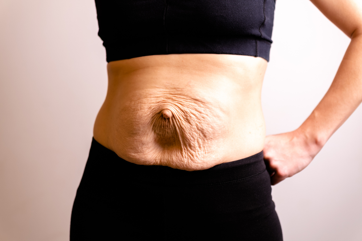 Stomach Strip (Add-on)